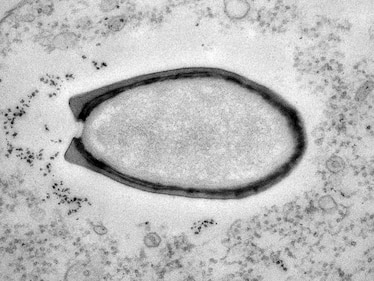 Electron microscopy image of a Pandoravirus particle.