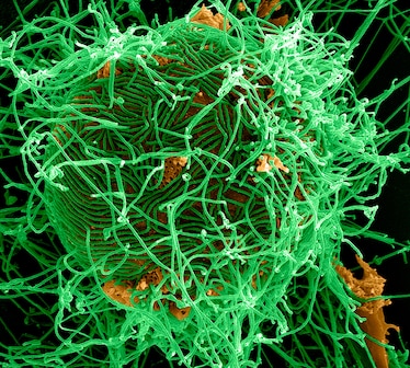 an ebola virus