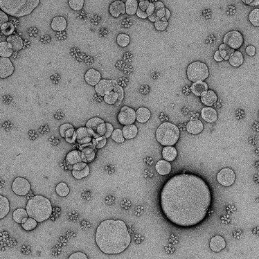 A negative-stain electron microscope image of the SARS-CoV-2 Spike Ferritin Nanoparticle (SpFN) Vaccine.