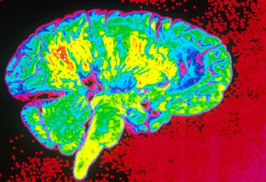 An enhanced, digitized median section of a normal human brain.